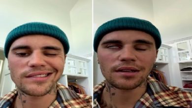 Photo of Justin Bieber: Half-face of pop singer Justin Bieber is paralyzed, increased concern of fans, such reaction on social media