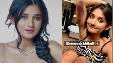 Photo of Kanika Mann: Actress Kanika Mann got badly injured during the task, pictures from the sets of Khatron Ke Khiladi went viral
