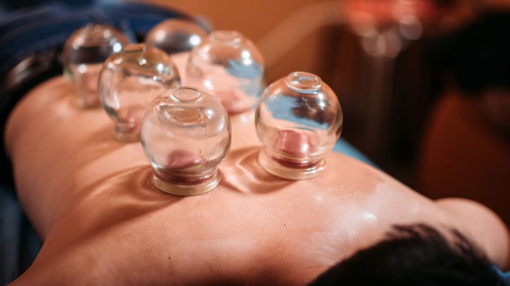 Cupping Therapy: Benefits for Skin and Health